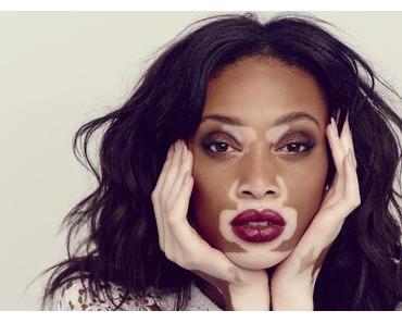 Gros plan sur Winnie Harlow