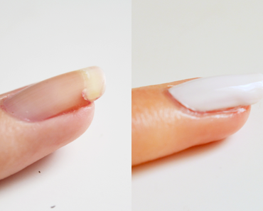 Comment réparer un ongle cassé : la méthode qui fonctionne !